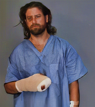 When Travis Barton tried to elude police, he was shot, but only suffered a finger wound. 